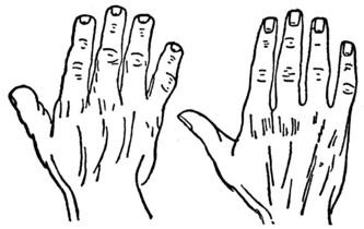 Plate I.Part II. Fig. 1THE ELEMENTARY HAND. Fig. 2THE SQUARE OR USEFUL HAND. Fig. 3THE SPATULATE HAND. Fig. 4THE PHILOSOPHIC HAND.