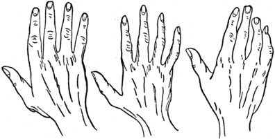 Plate II. Part II. Fig. 1.THE CONIC OR ARTISTIC HAND. Fig. 2.THE PSYCHIC OR IDEALISTIC HAND. Fig. 3.THE MIXED HAND.