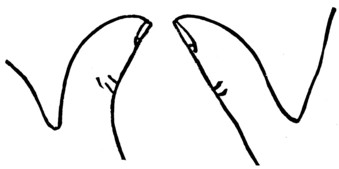 Fig. 2.THE SUPPLE-JOINTED THUMB. Fig. 3.THE FIRM-JOINTED THUMB. 
